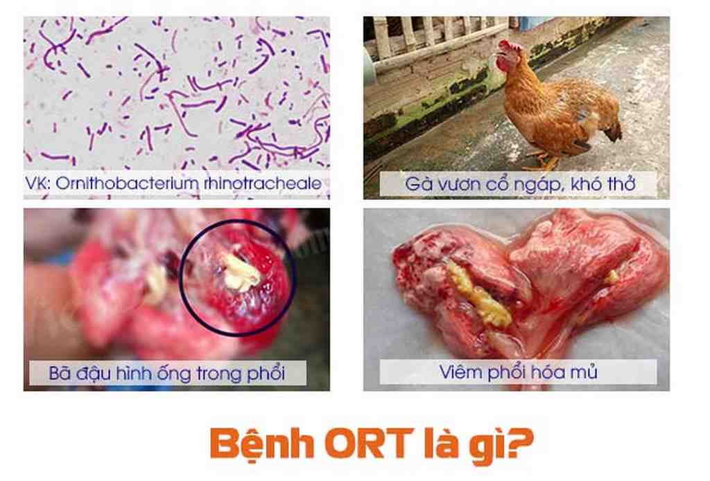 bệnh ORT