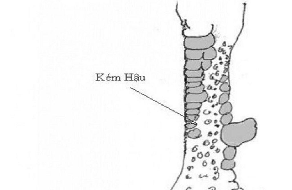 vảy gà xấu